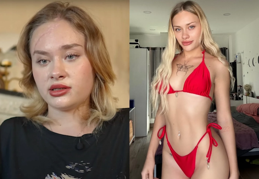 "Мы будем делать с тобой всё, что хотим". Искалеченная в Дубае украинская модель впервые рассказала о трагедии