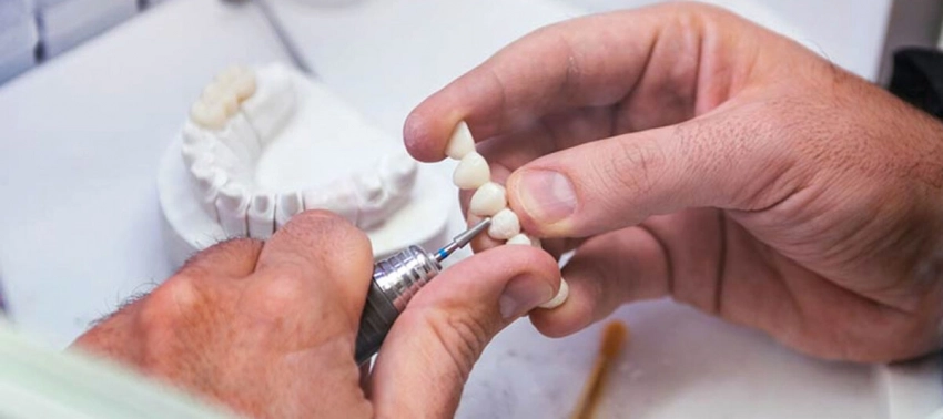 Современные подходы к лечению зубов и протезированию